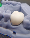dental temporary bridge material