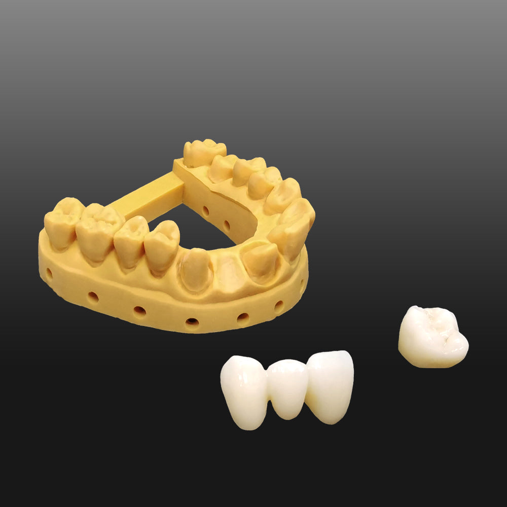 Polished Dental Bridge made