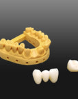 Polished Dental Bridge made